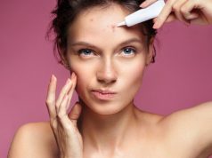 Как лечить угревую сыпь