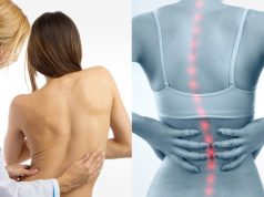 Лучший способ исправить осанку в домашних условиях