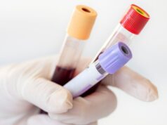 Какие симптомы являются поводом сдать анализ на СРБ